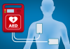 สรุปประเด็น การติดตั้งเครื่อง AED ในอาคารสูงและพื้นที่สาธารณะ เพื่อผู้ป่วยภาวะหัวใจหยุดเต้น